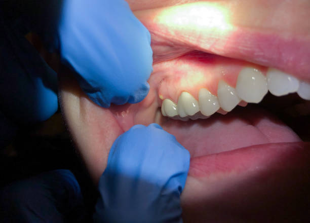 Best Emergency Gum Pain Relief  in Twin Falls, ID
