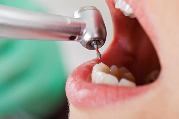 Best Root Canal Emergency Dentist  in Twin Falls, ID